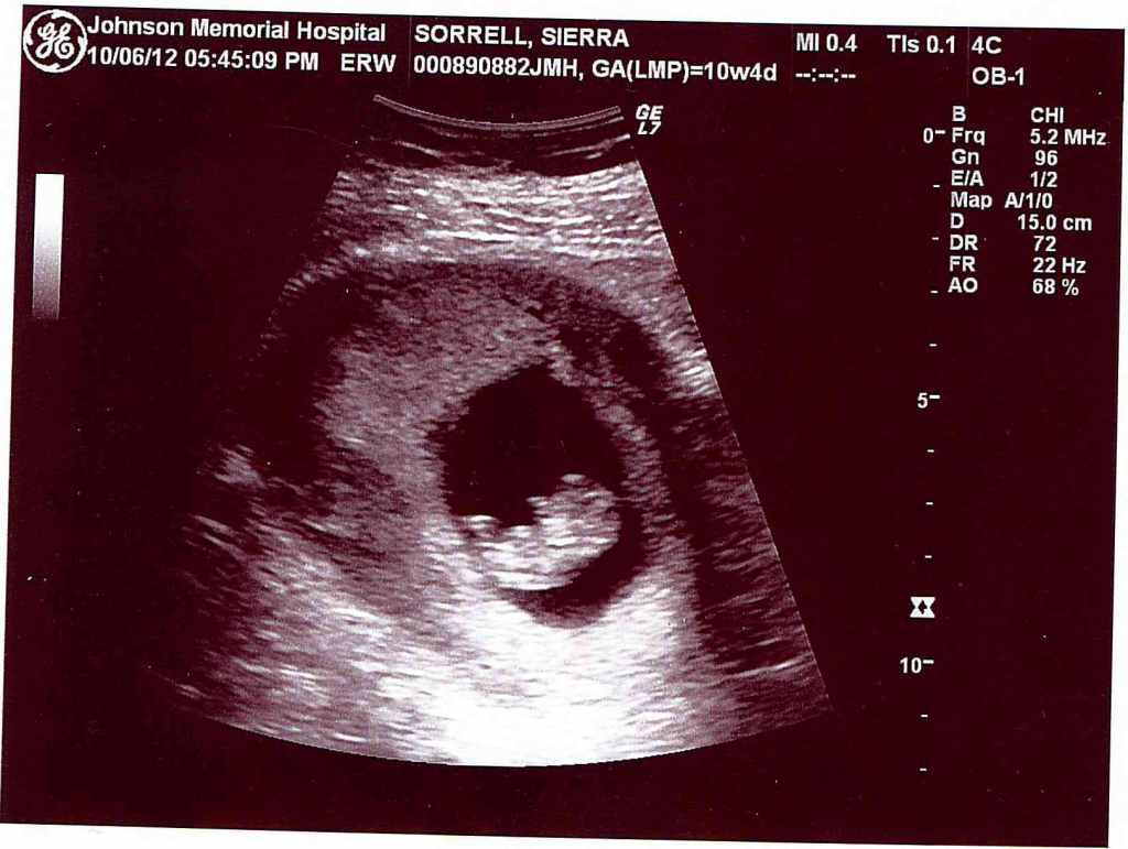 Scampi's First Photo